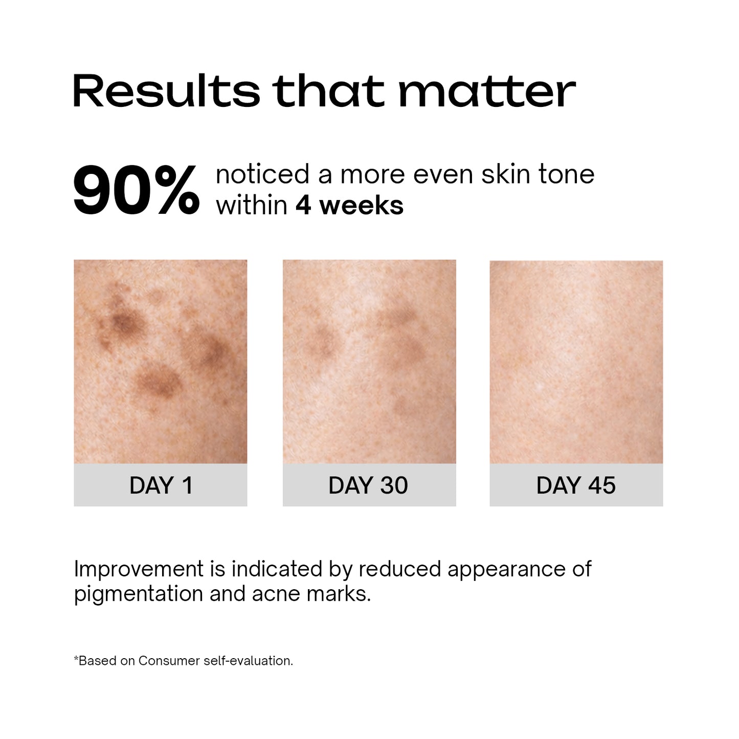 Alpha Arbutin 2% + Niacinamide 1% Serum
