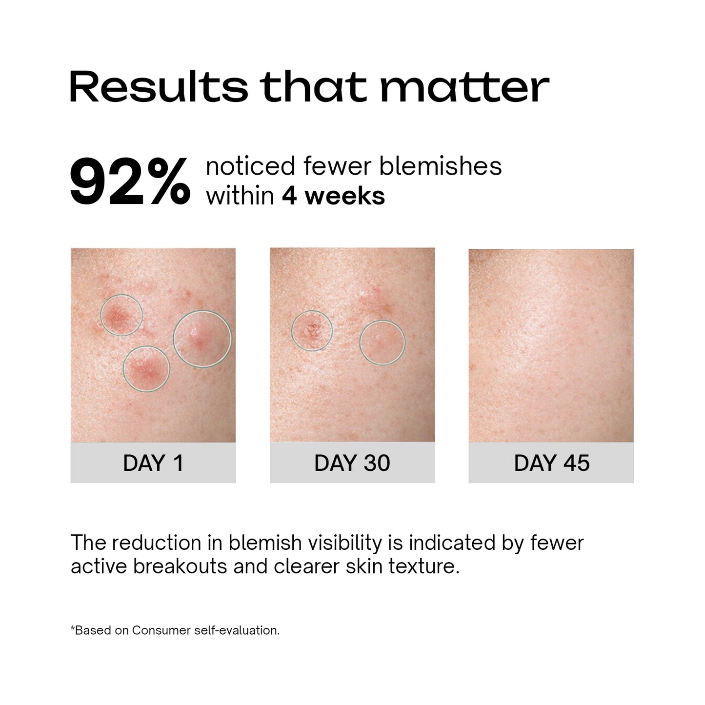 Salicylic Acid 2% + Tranexamic Acid 2% Serum