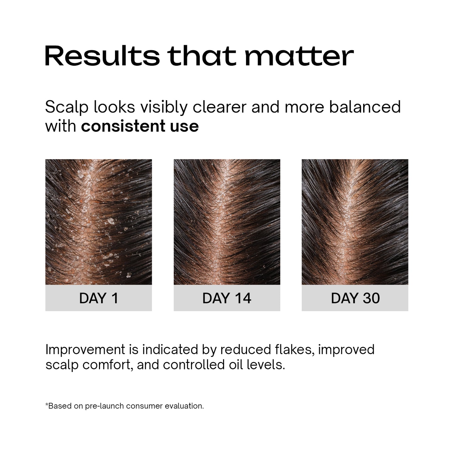 Anti-Dandruff Scalp Serum