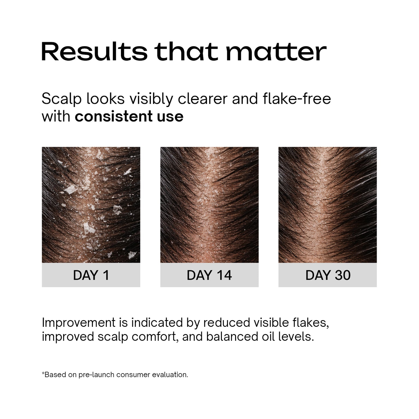 SLS-Free Anti-Dandruff Shampoo