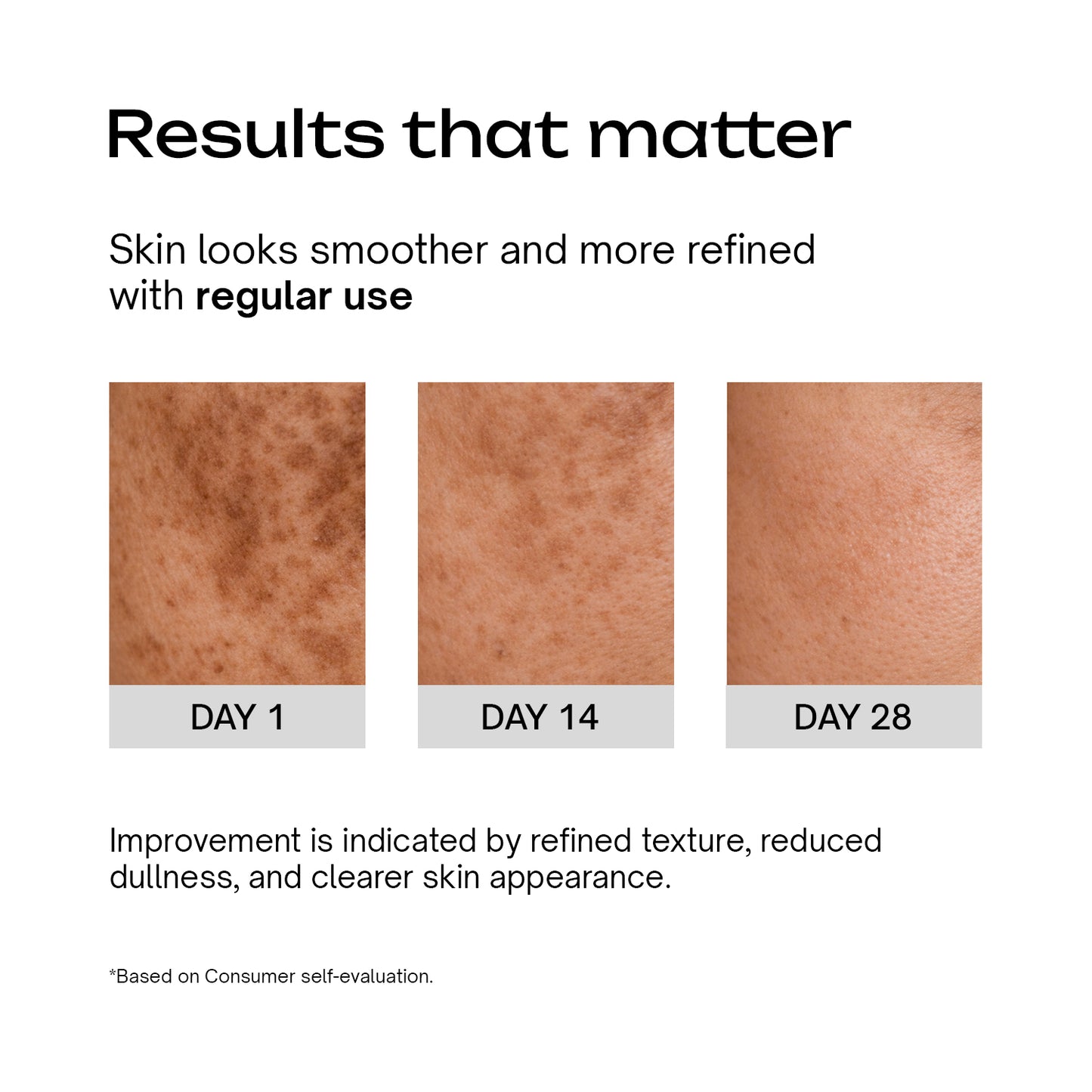 8% Glycolic Acid + 1% Salicylic Acid + 1% GDL Multipurpose Toning Solution