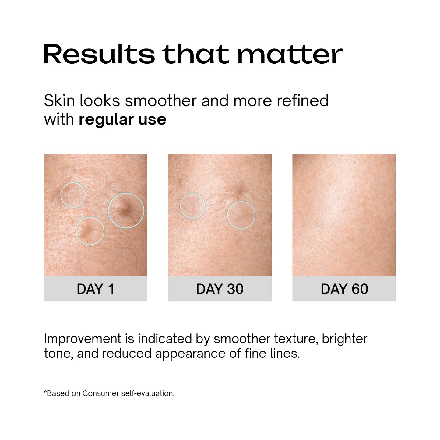 Retinol Serum for Beginners