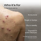 2% Salicylic Acid Acne Free Body Wash