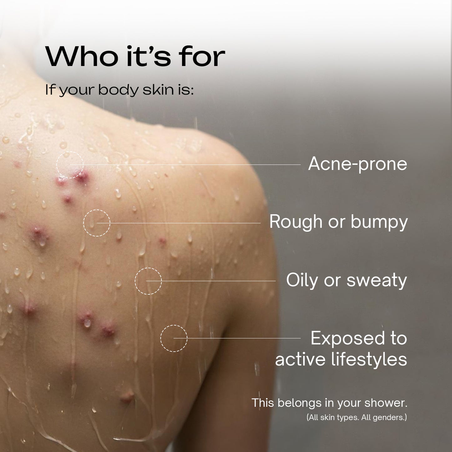 2% Salicylic Acid Acne Free Body Wash