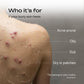 Acne Free Body Moisturizer