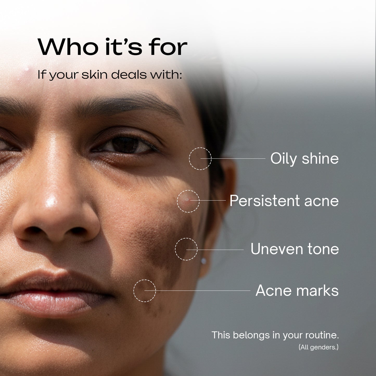 Azelaic Acid 9% GDL 5% Niacinamide 4% Cream