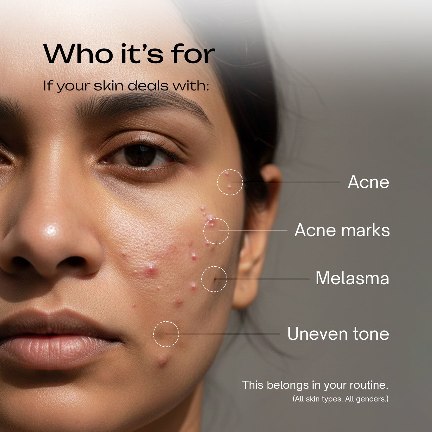 Salicylic Acid 2% + Tranexamic Acid 2% Serum