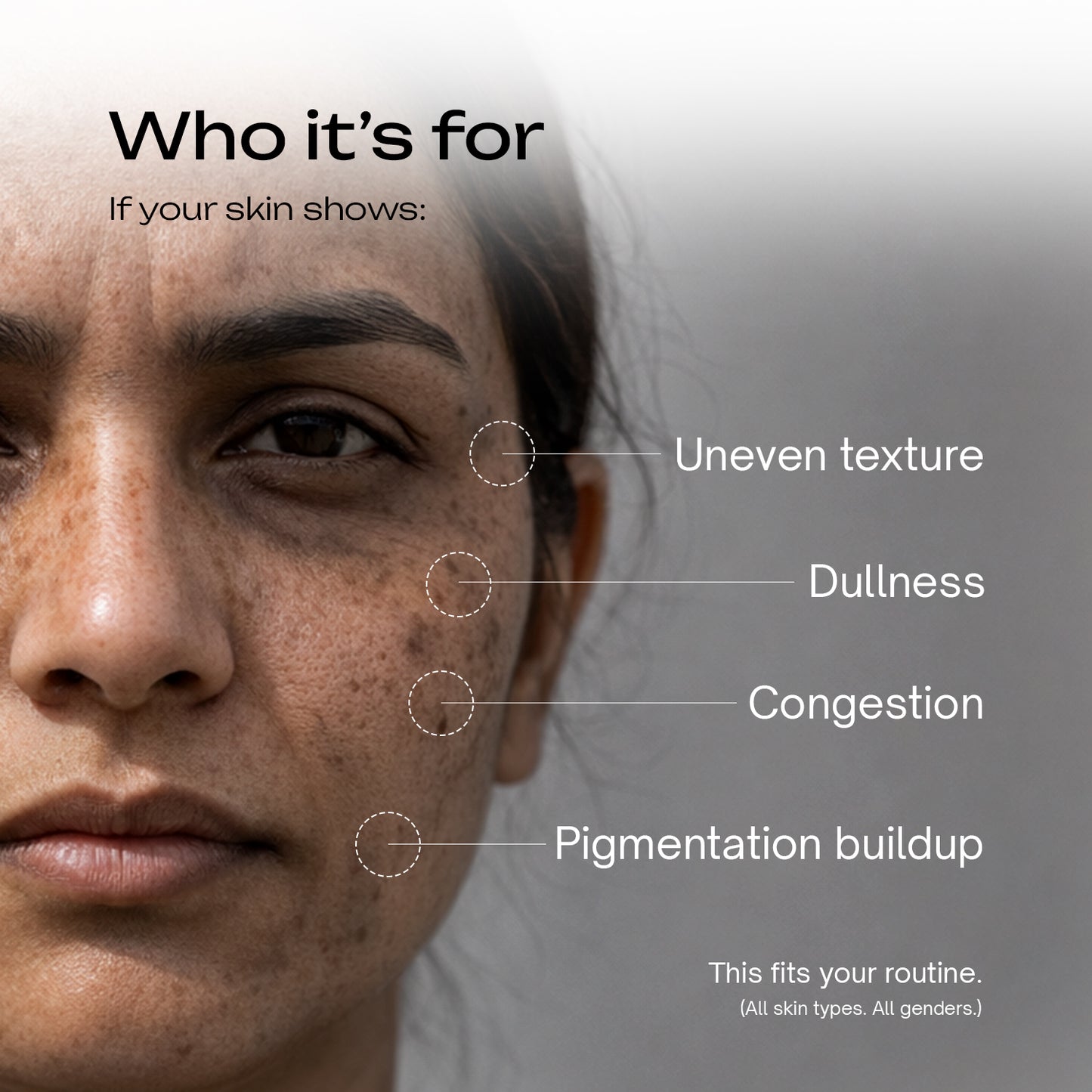 8% Glycolic Acid + 1% Salicylic Acid + 1% GDL Multipurpose Toning Solution