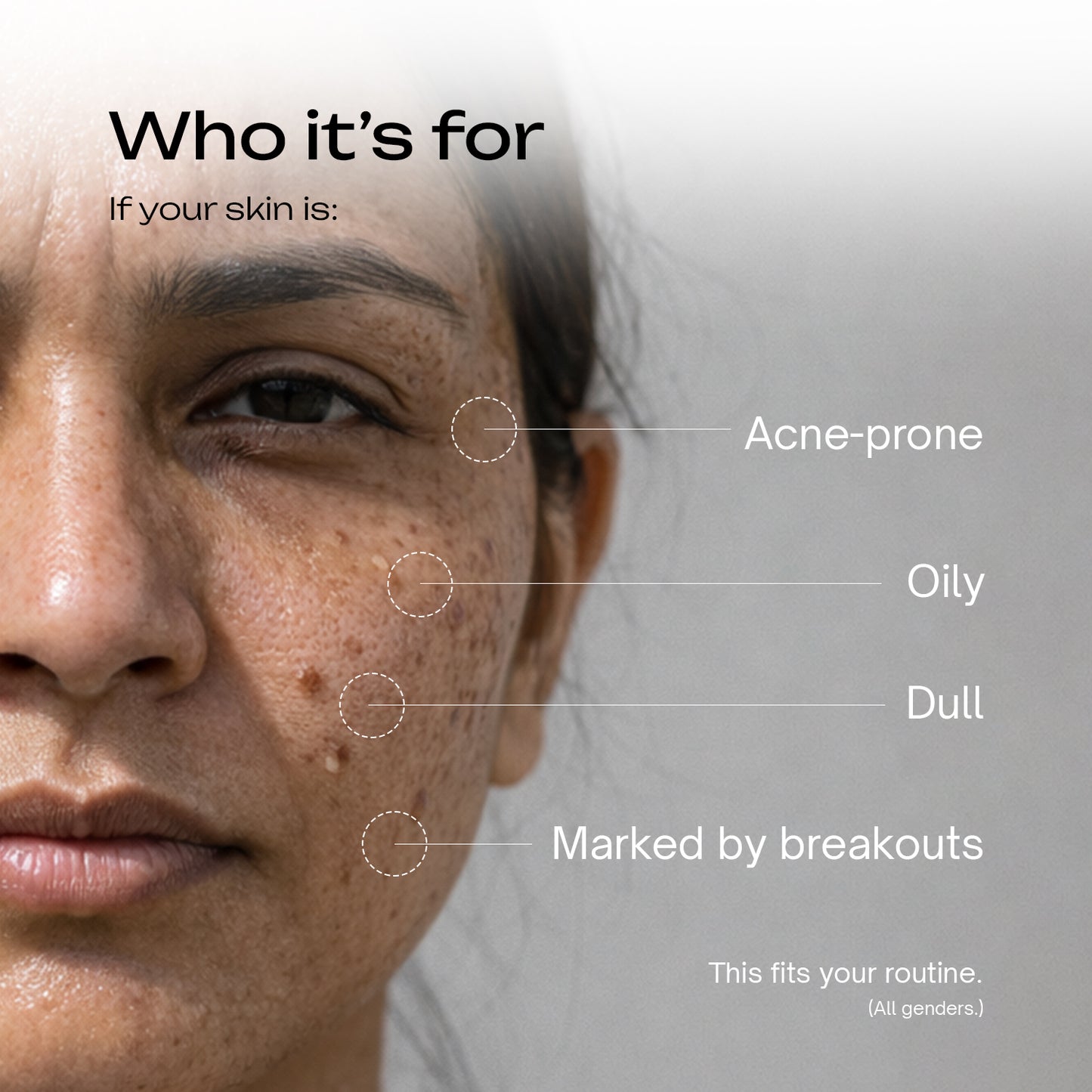 Glow and Acne Clear Face Moisturiser