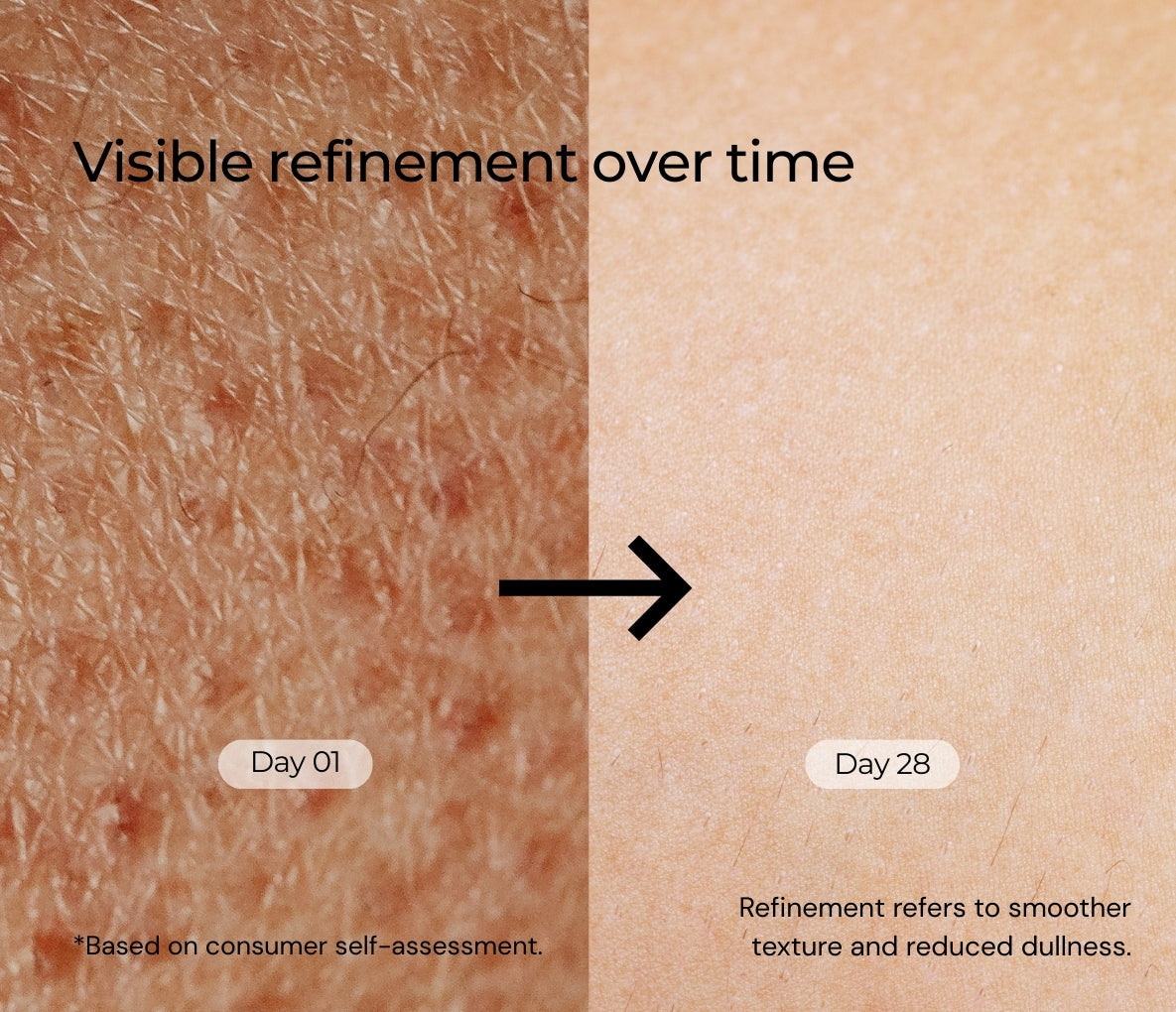 25% Aha + 2% Bha + 5% Pha Peeling Solution