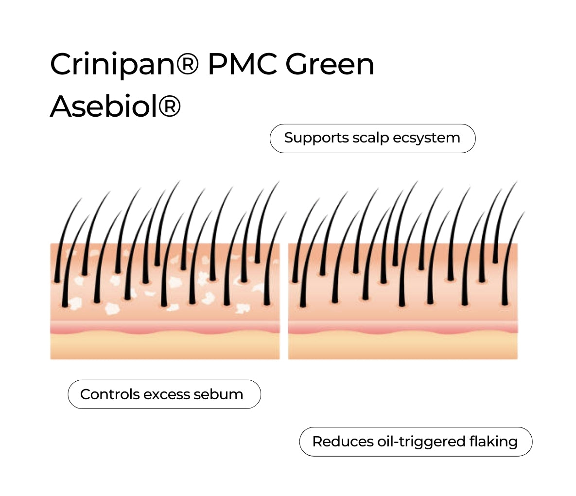 Anti-Dandruff Scalp Serum