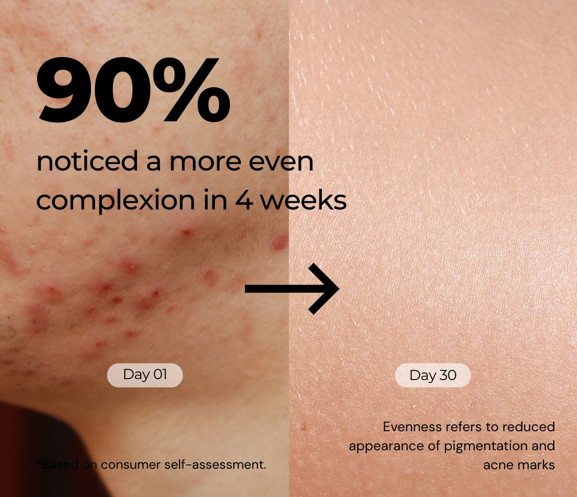 Alpha Arbutin 2% + Niacinamide 1% Serum