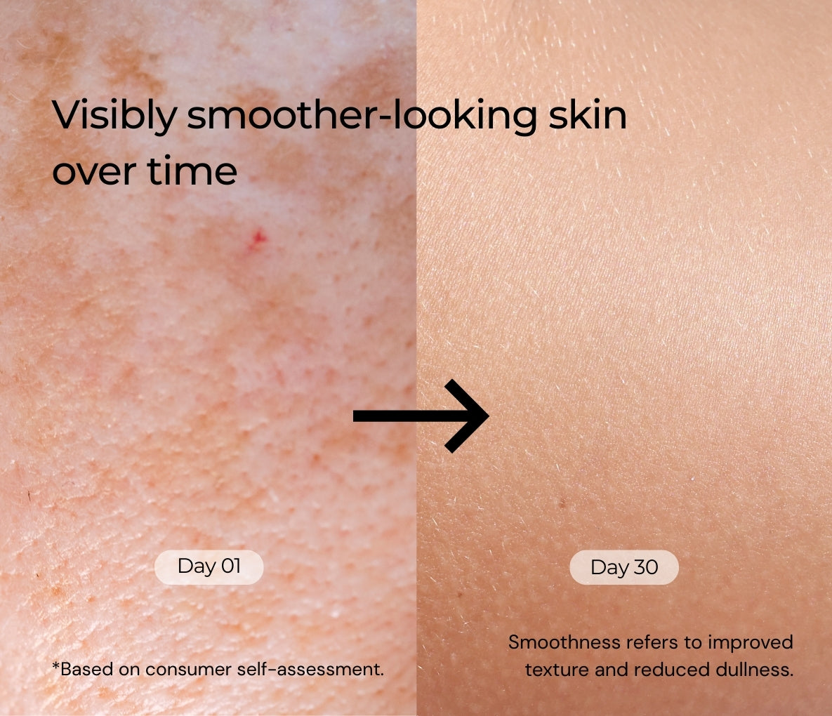 8% Glycolic Acid + 1% Salicylic Acid + 1% GDL Multipurpose Toning Solution