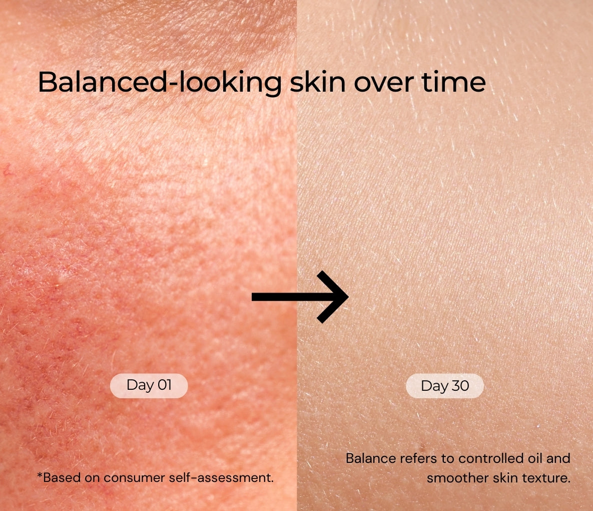 Niacinamide 5% Betaine 3% Serum