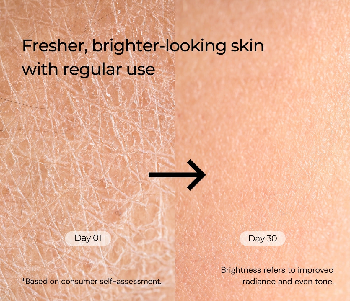 Purifying and Acne Free Gel Face Wash