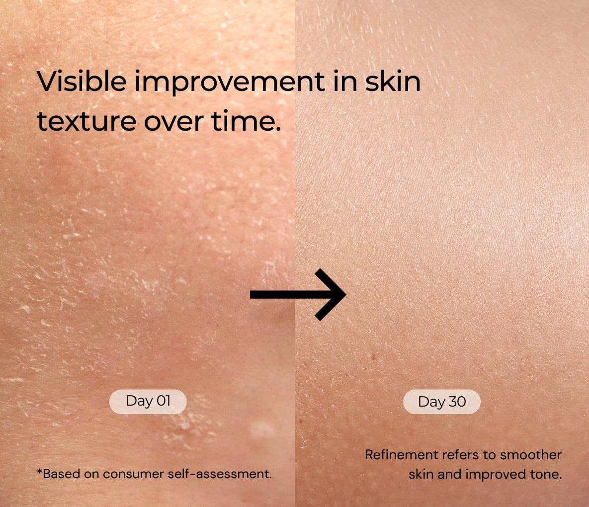 Retinol Serum for Beginners