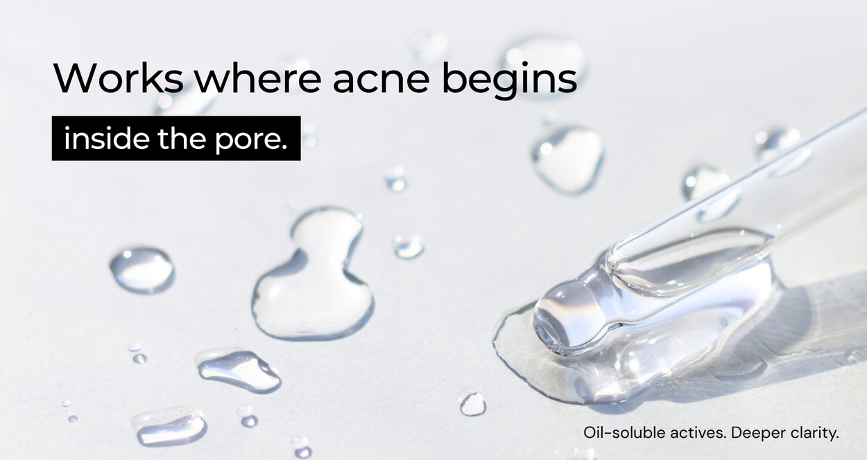 Salicylic Acid 2% + Tranexamic Acid 2% Serum